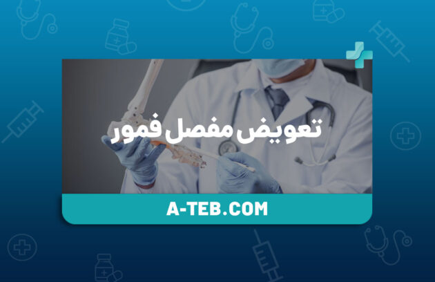 تعویض مفصل فمور