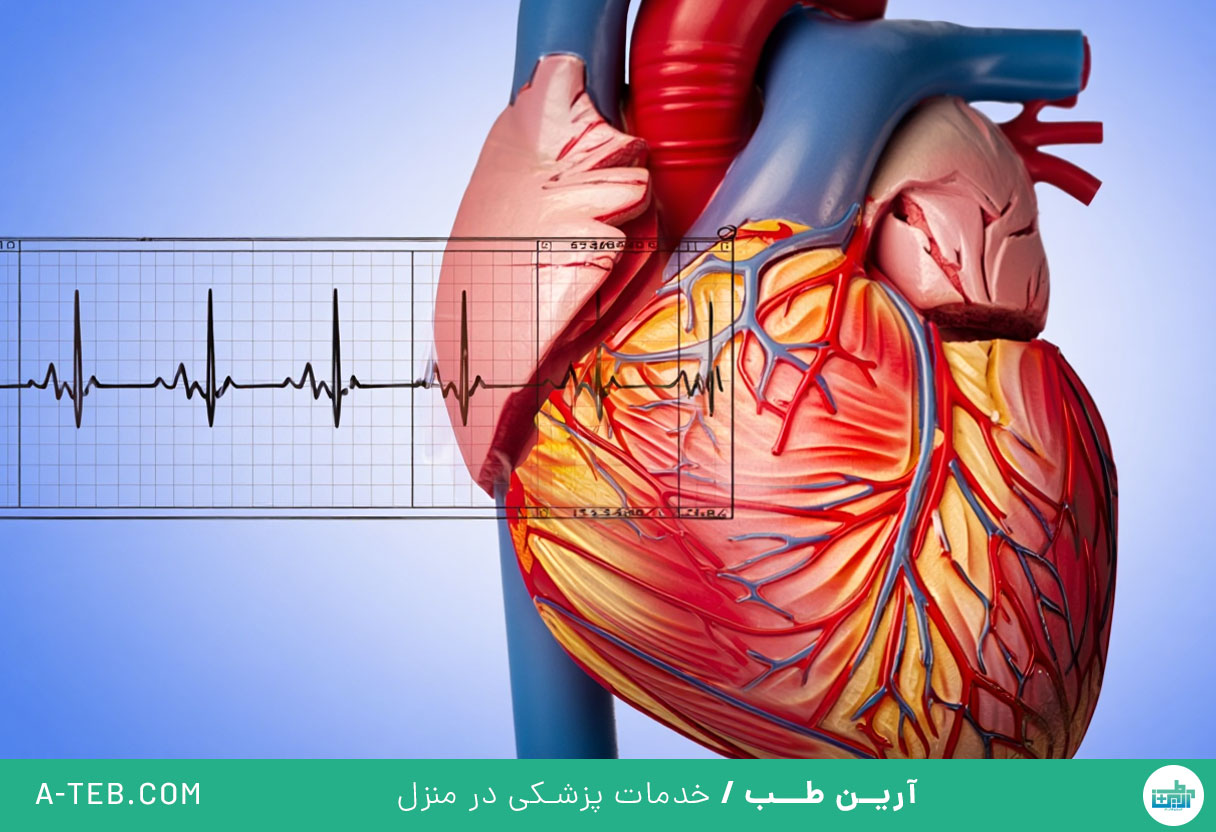 آریتمی قلبی