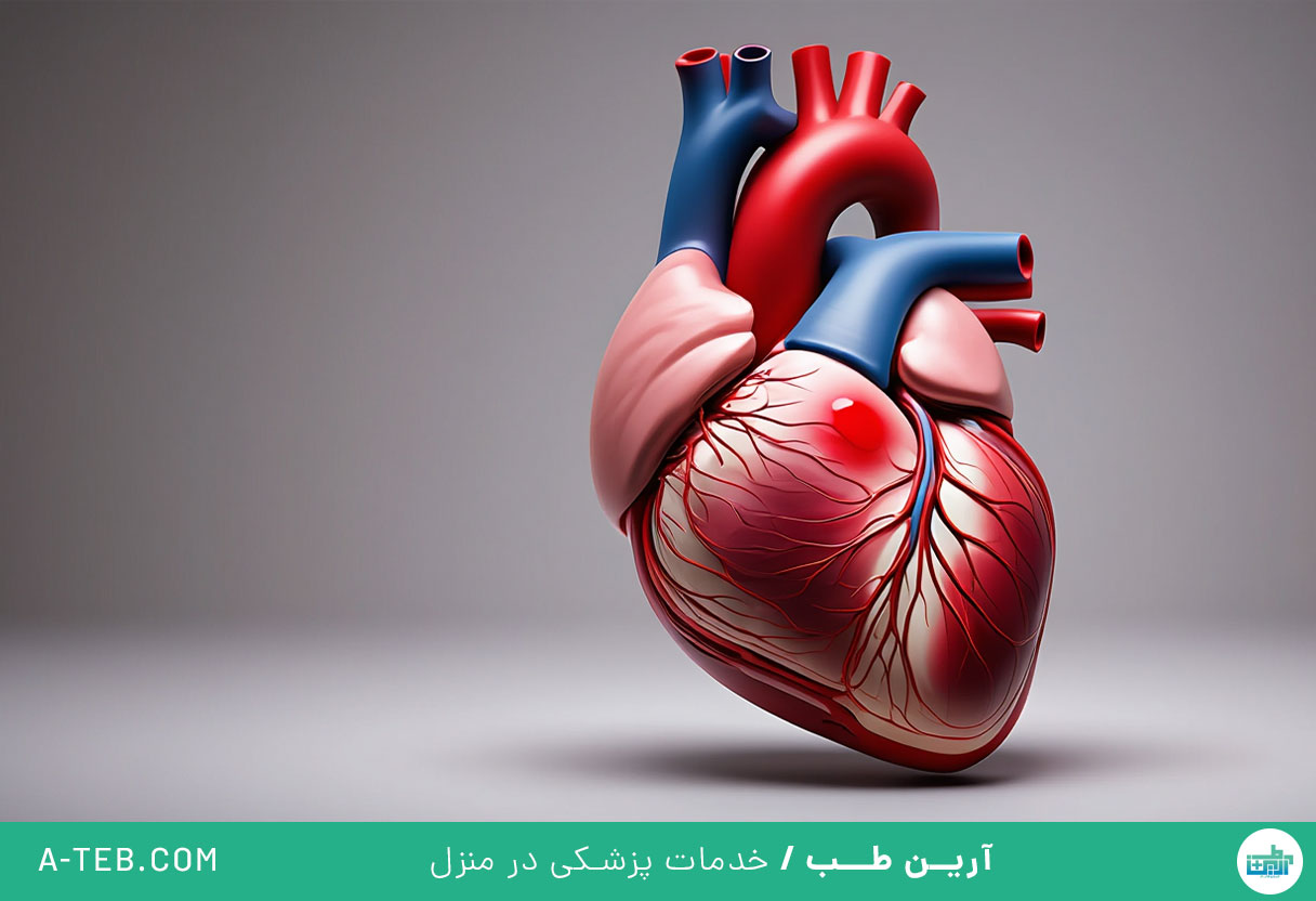 سکته قلبی بزرگ