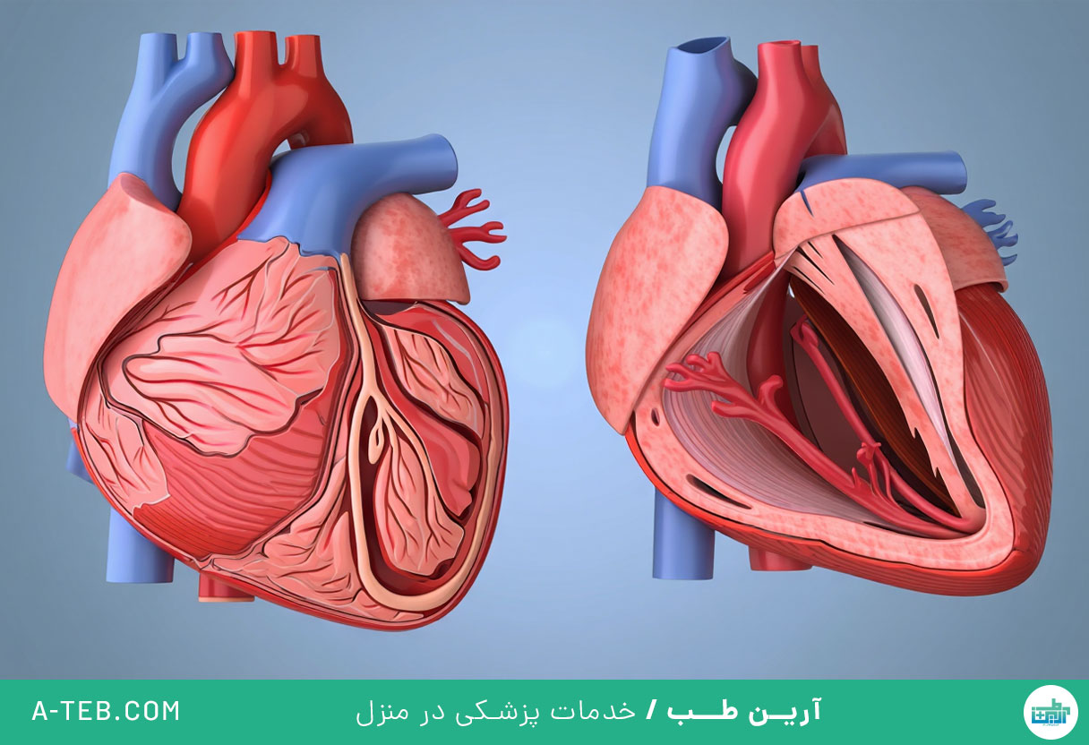افتادگی دریچه میترال