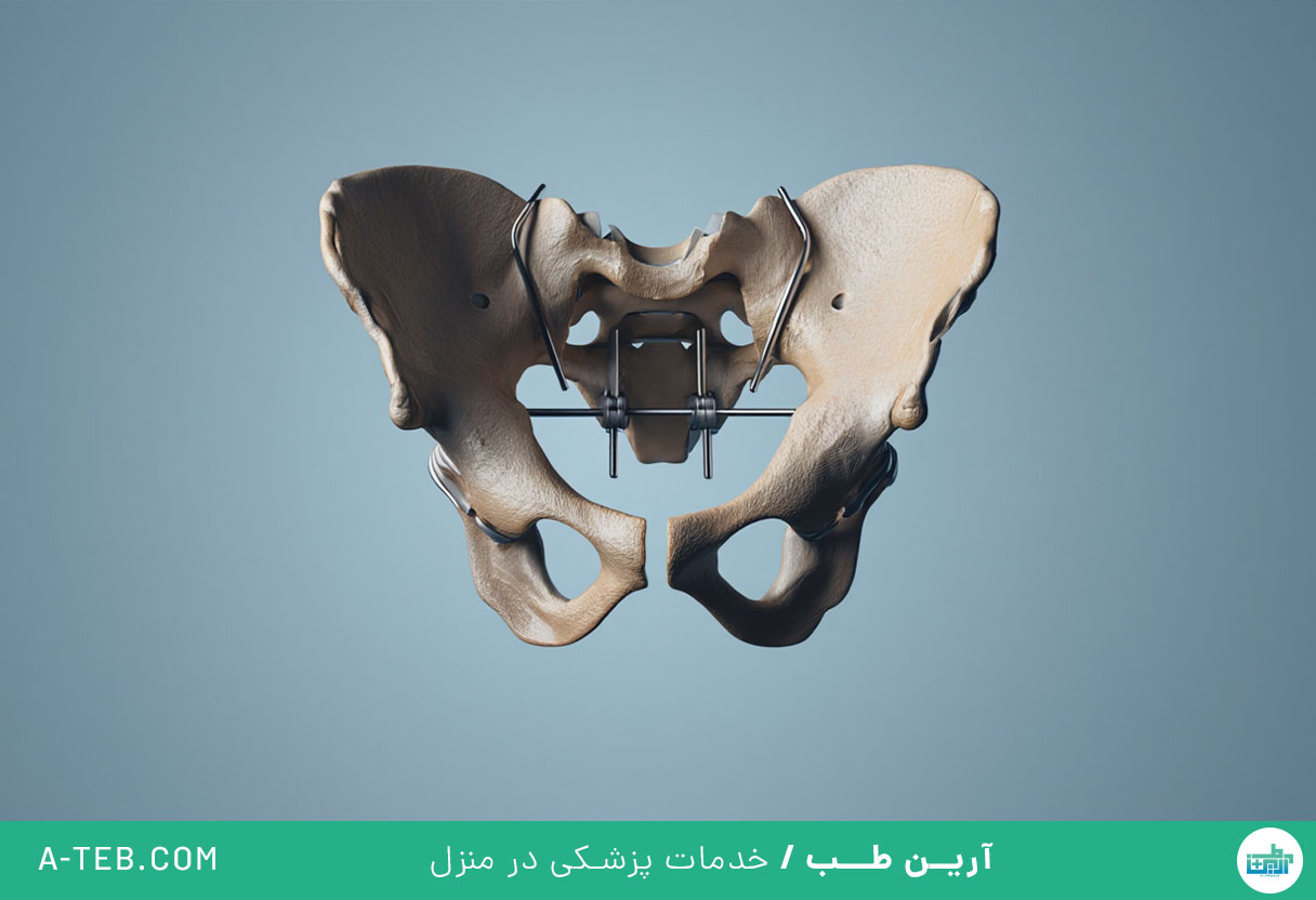 جراحی شکستگی لگن