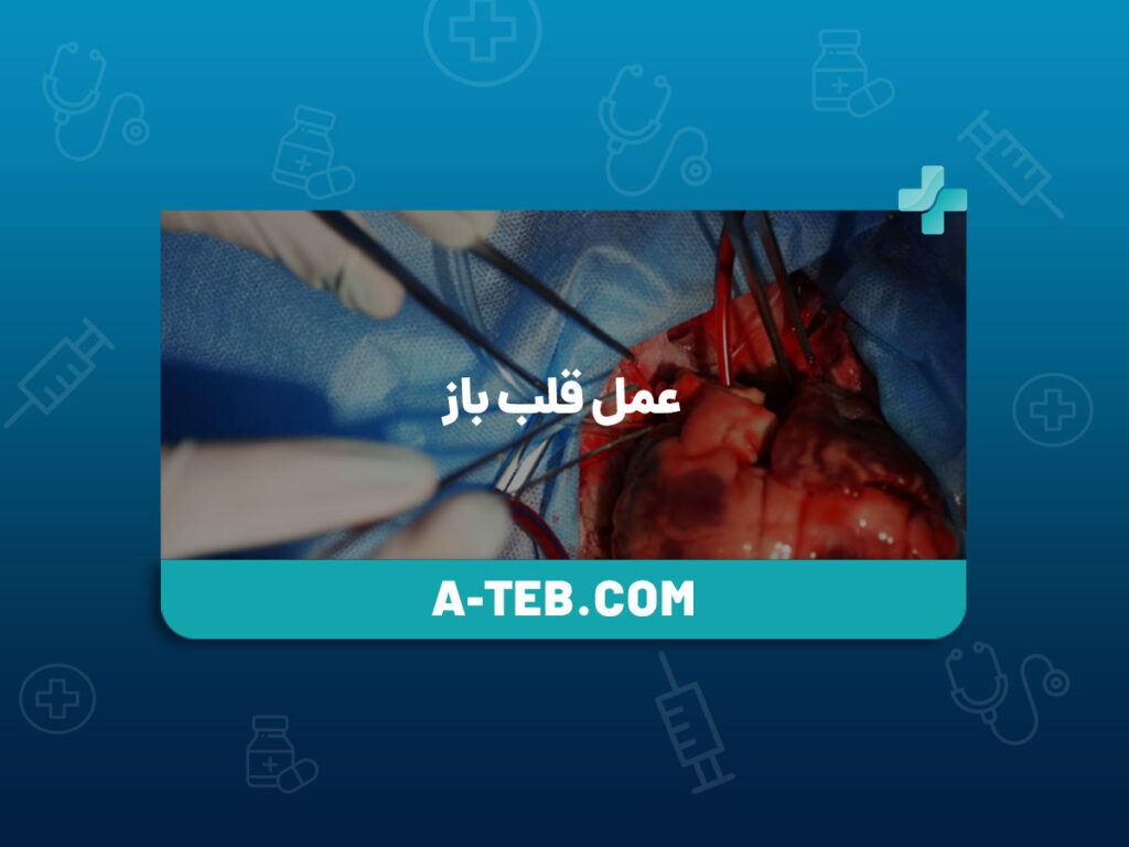 عمل قلب باز