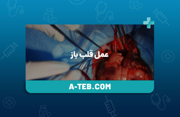 عمل قلب باز