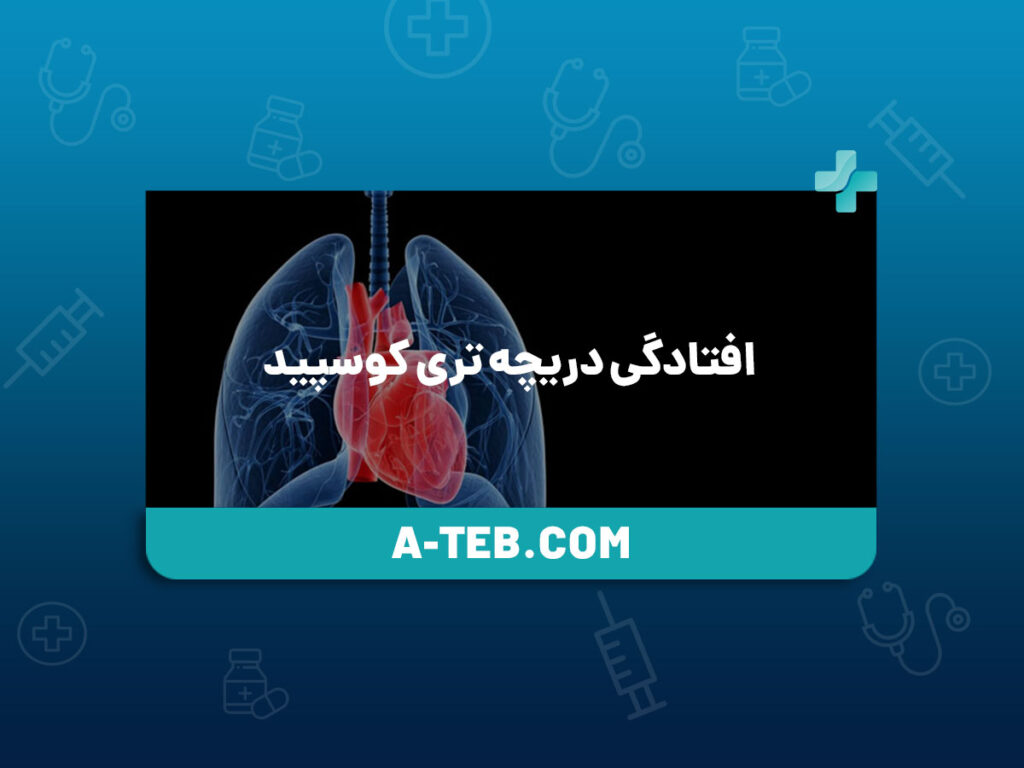 افتادگی دریچه تری کوسپید