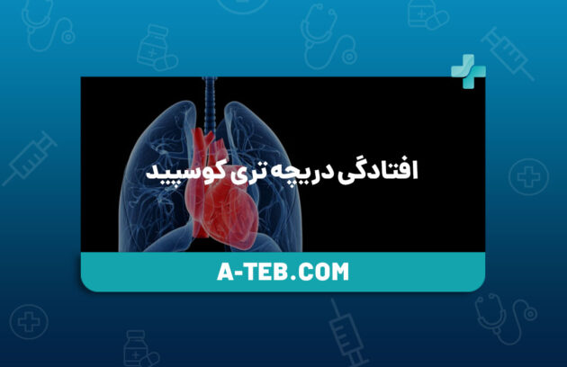 افتادگی دریچه تری کوسپید