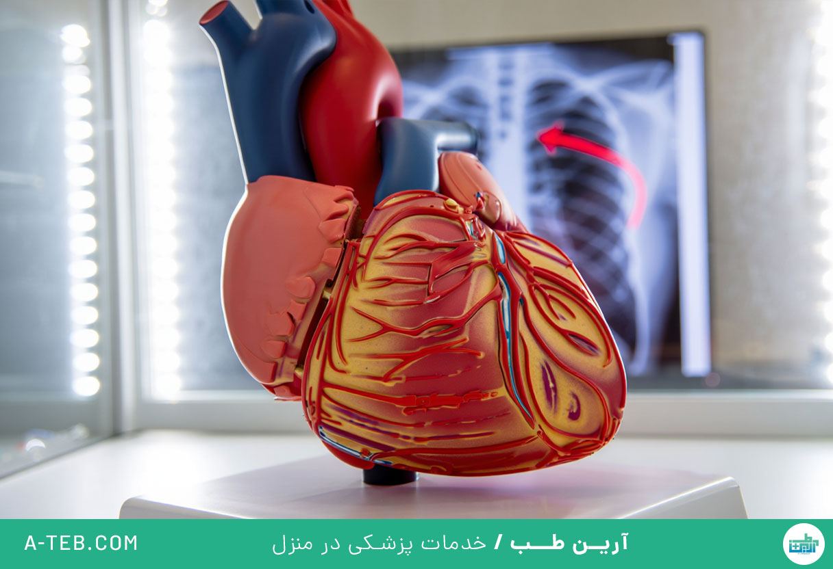 افتادگی دریچه میترال