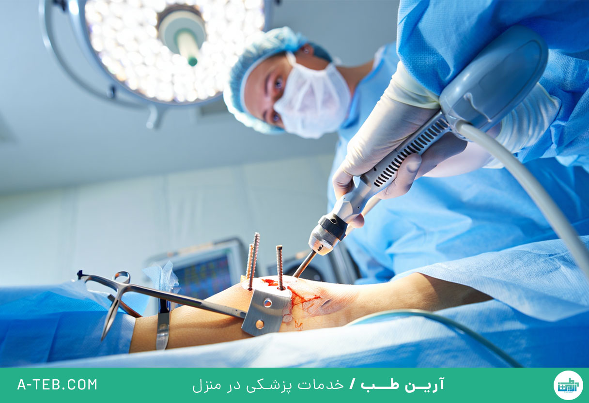 عمل شکستگی فمور