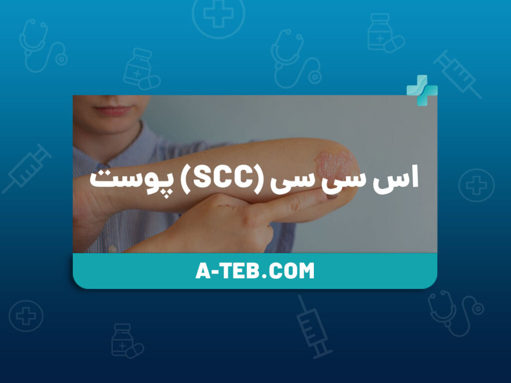 SCC پوست