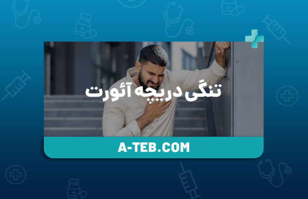 تنگی دریچه آئورت