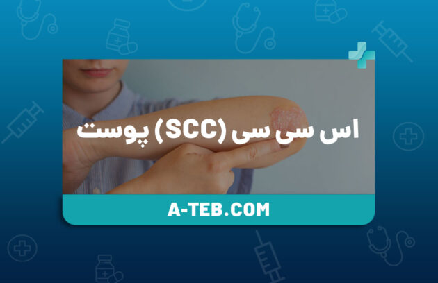 SCC پوست