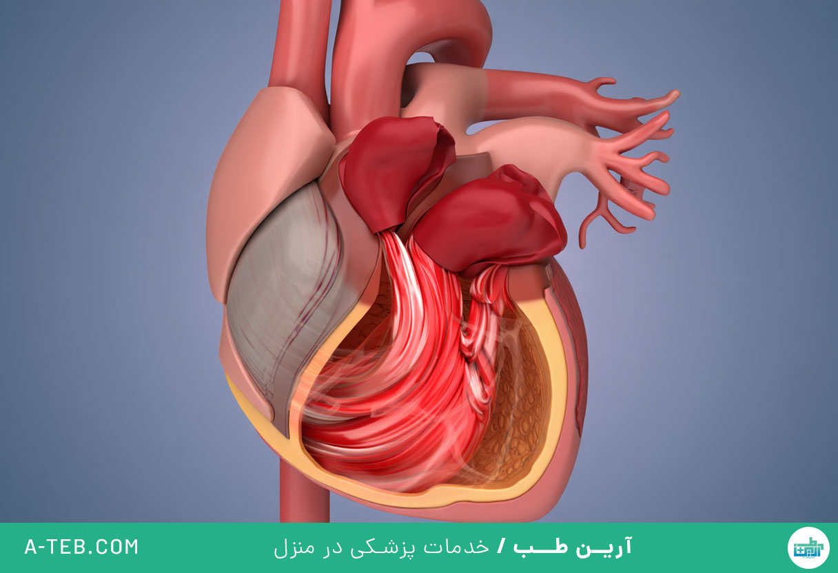 افتادگی دریچه آئورت