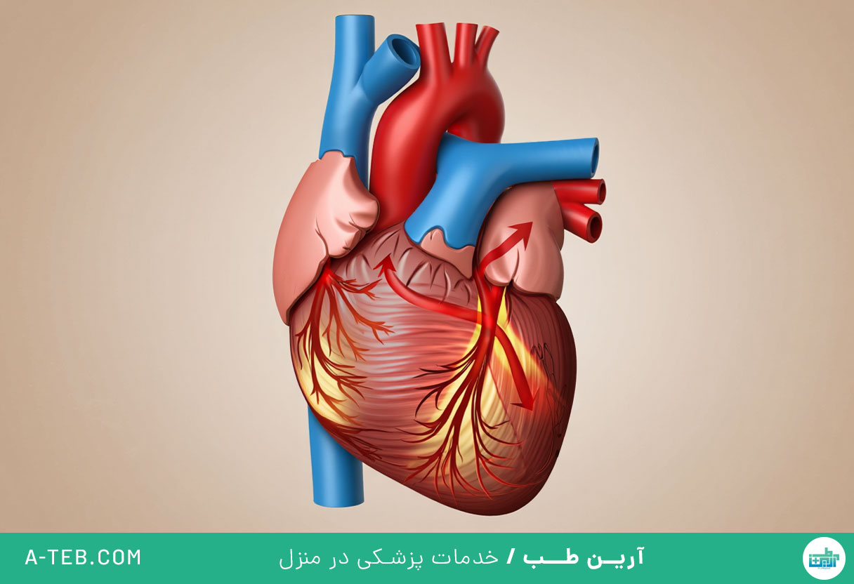 افتادگی دریچه آئورت