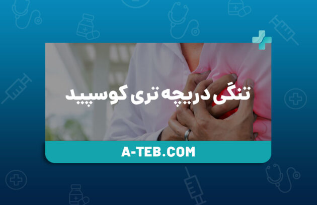 تنگی دریچه تری کوسپید