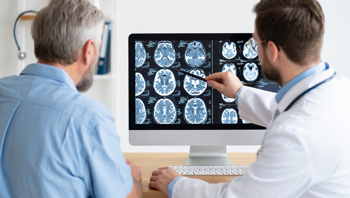 سکته مغزی حاد