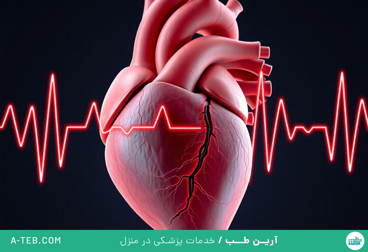 فیبریلاسیون دهلیزی