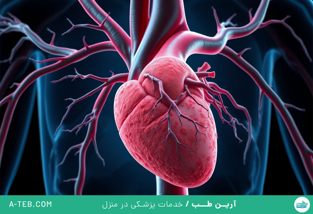 بیماری عروق کرونر