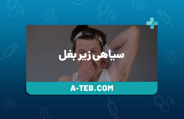 سیاهی زیر بغل