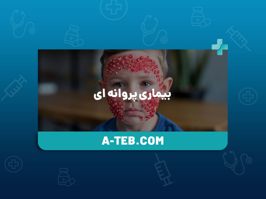 بیماری پروانه ای