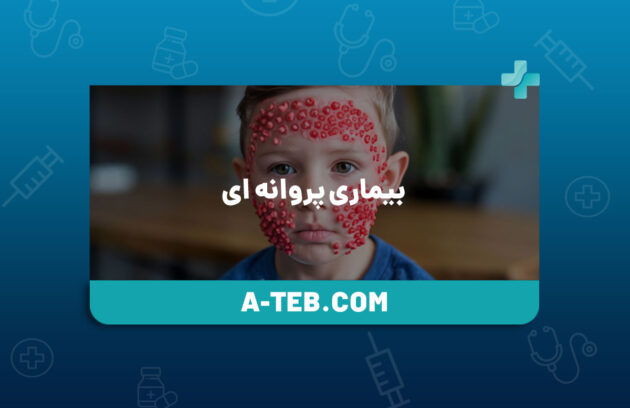 بیماری پروانه ای