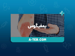 پمفیگوس