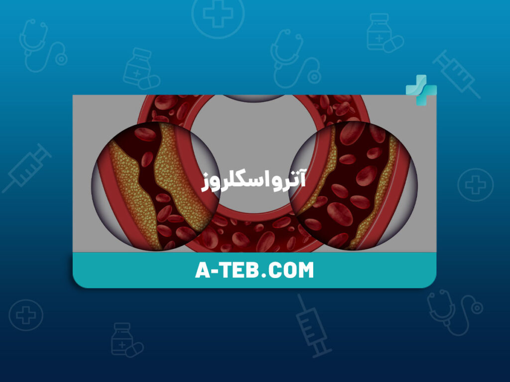 آترواسکلروز
