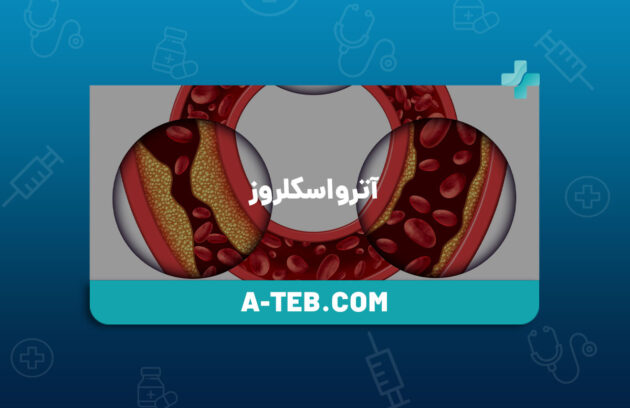 آترواسکلروز