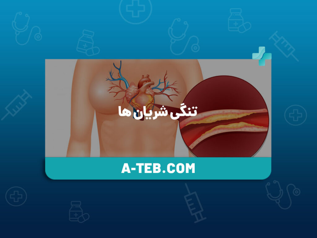 تنگی شریان ها