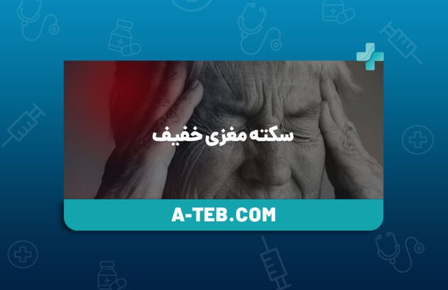 سکته مغزی خفیف