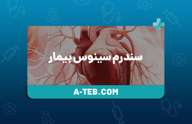 سندرم سینوس بیمار