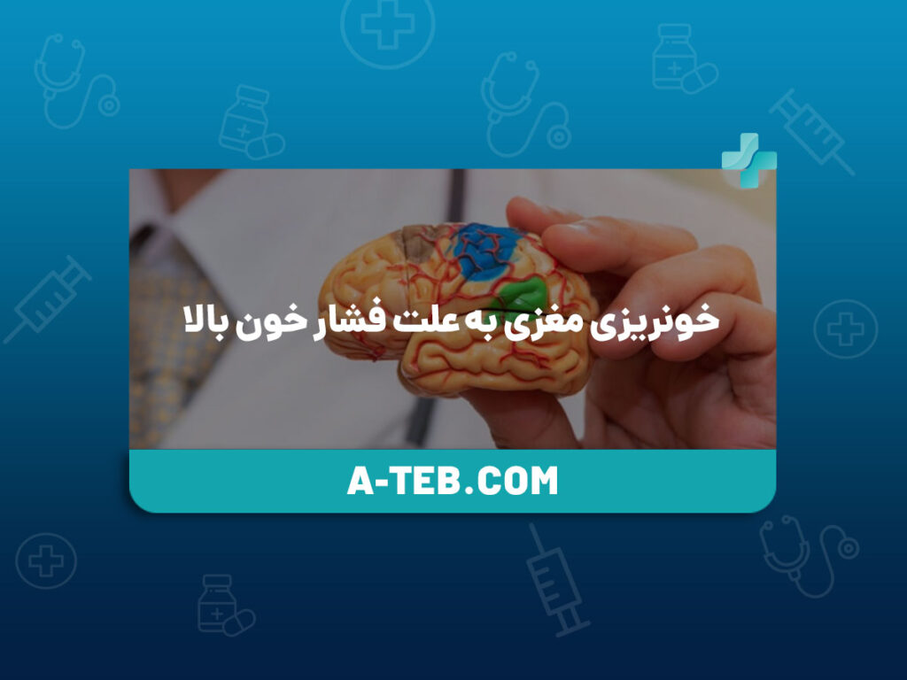 خونریزی مغزی به علت فشار خون بالا