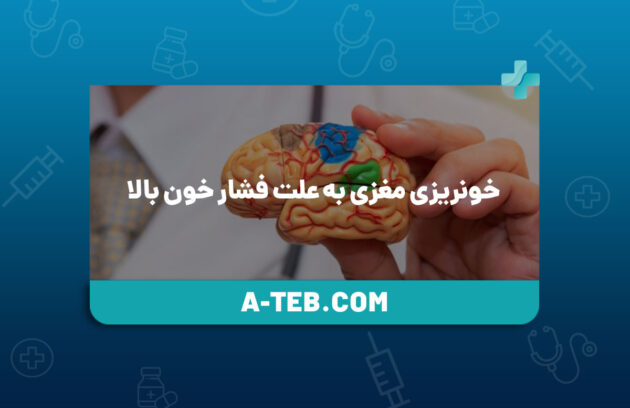 خونریزی مغزی به علت فشار خون بالا