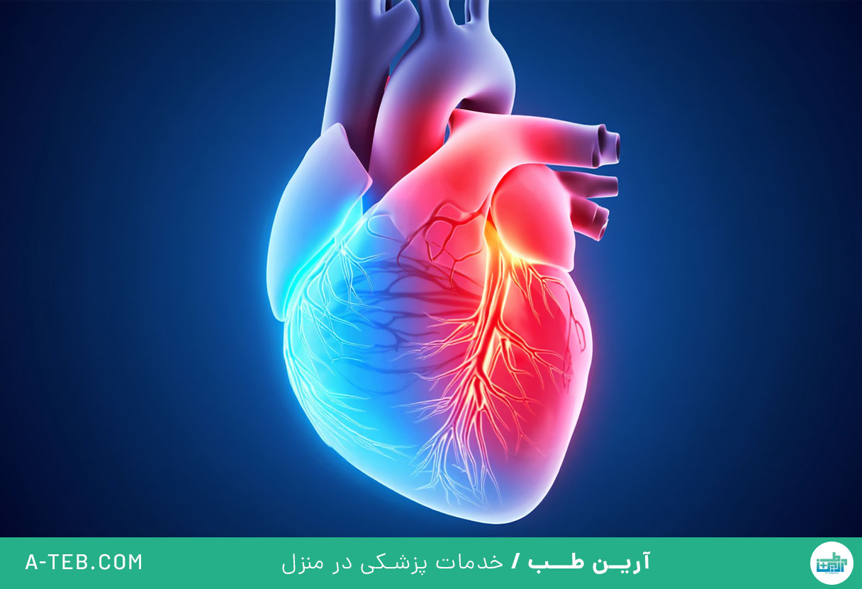 تاکی کاردی بطنی