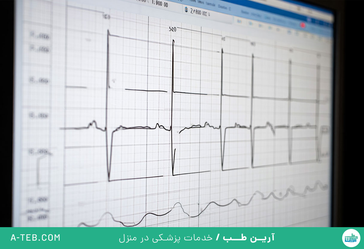 سندرم قلب ورزشکاران
