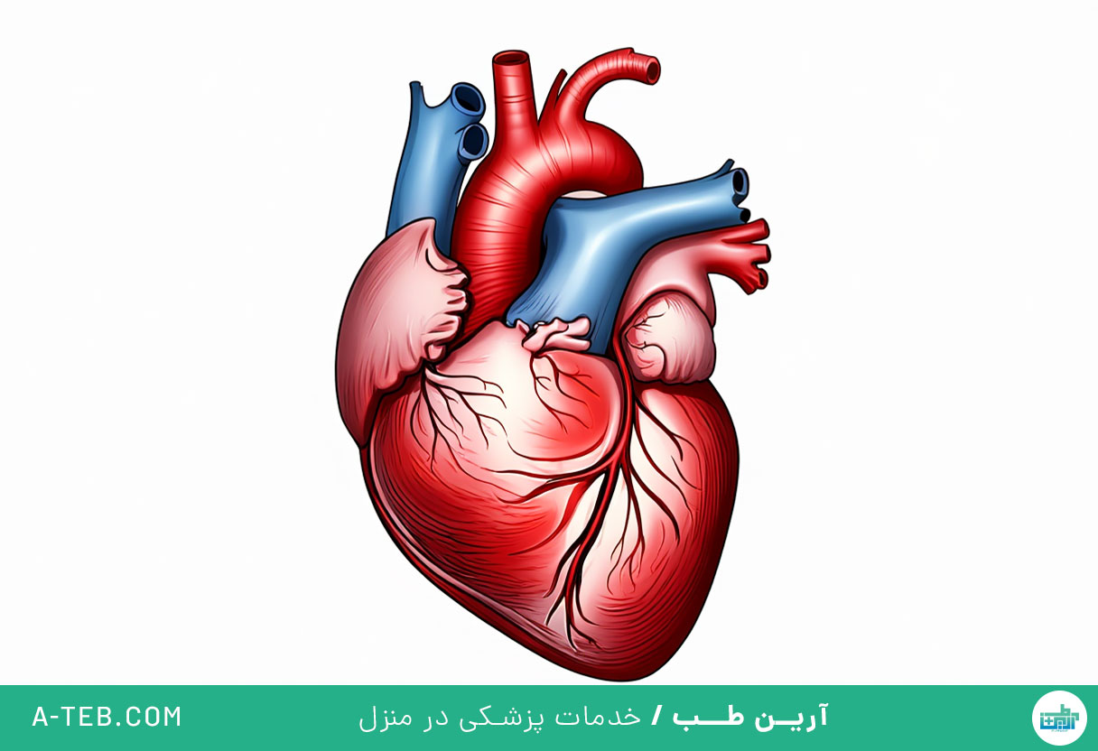 میوکاردیت