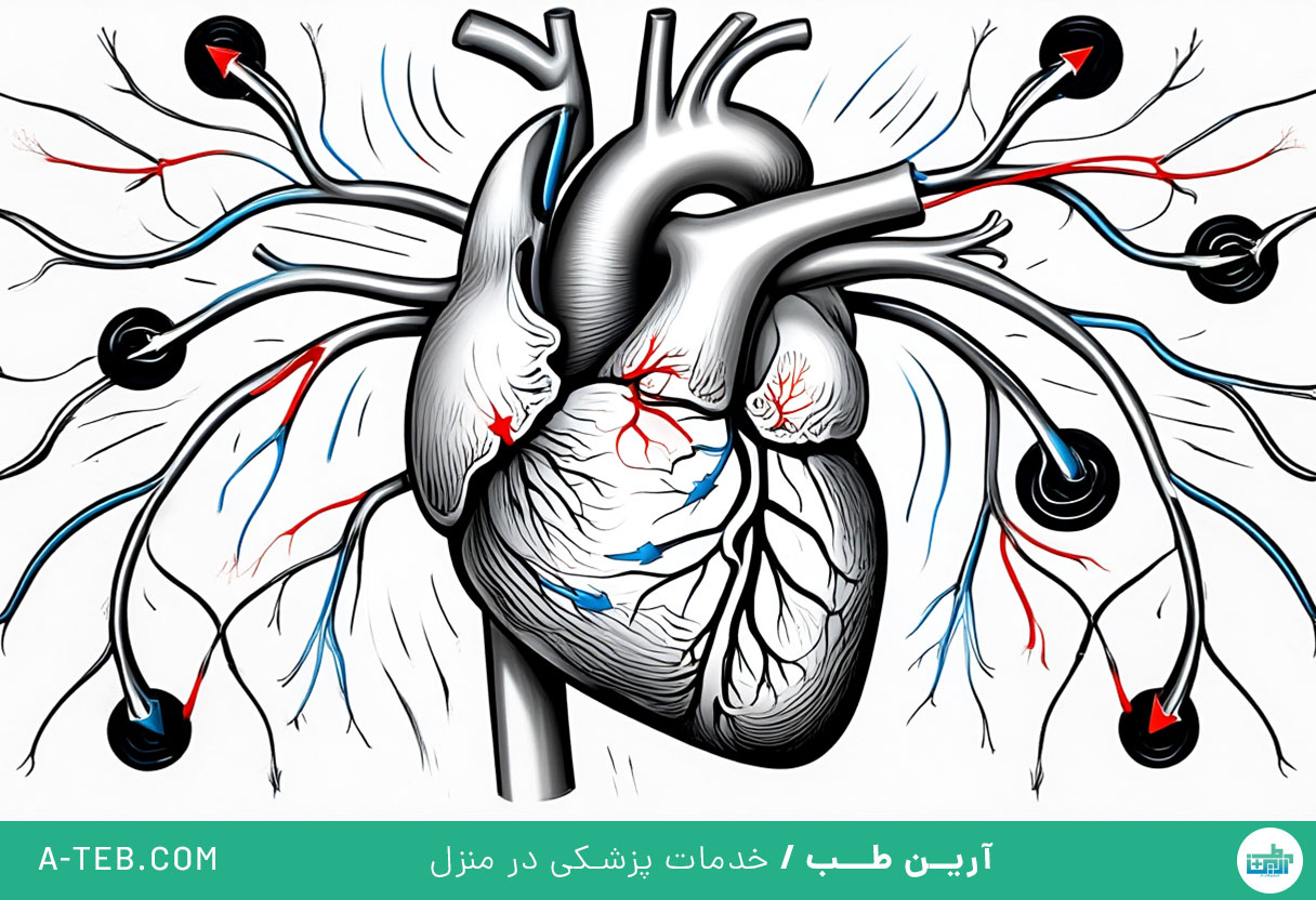 بیماری ایسکمیک قلبی