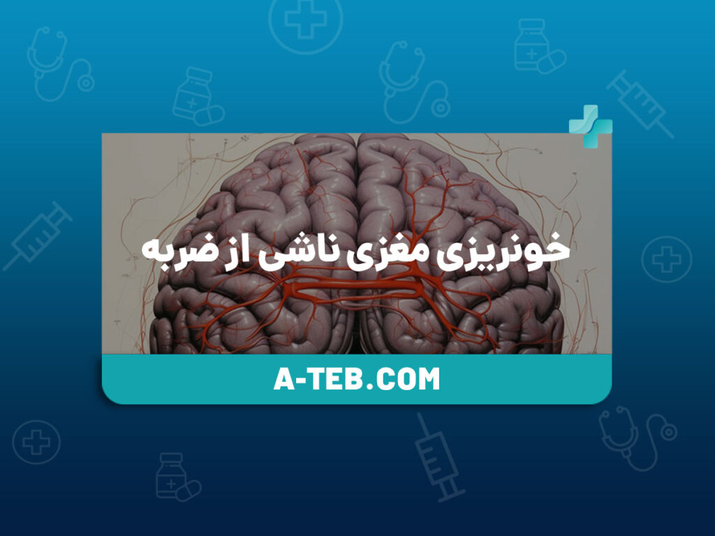 خونریزی مغزی ناشی از ضربه