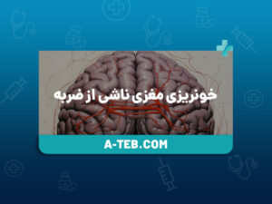 خونریزی مغزی ناشی از ضربه