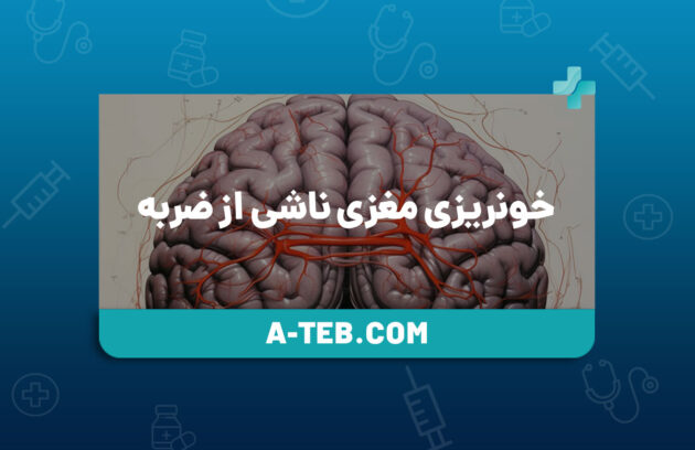 خونریزی مغزی ناشی از ضربه