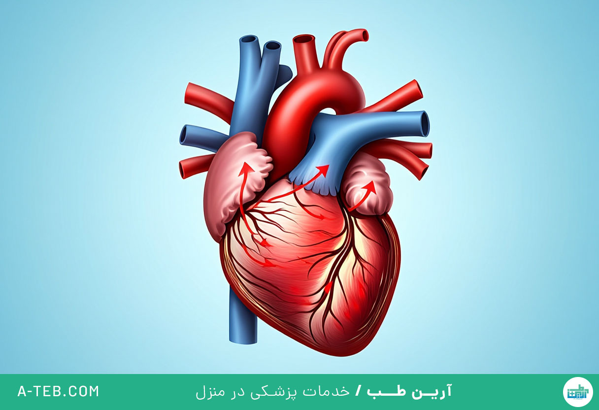 بیماری ایسکمیک قلبی