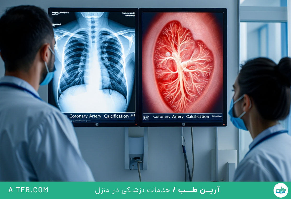 کلسیفیکاسیون عروق کرونر