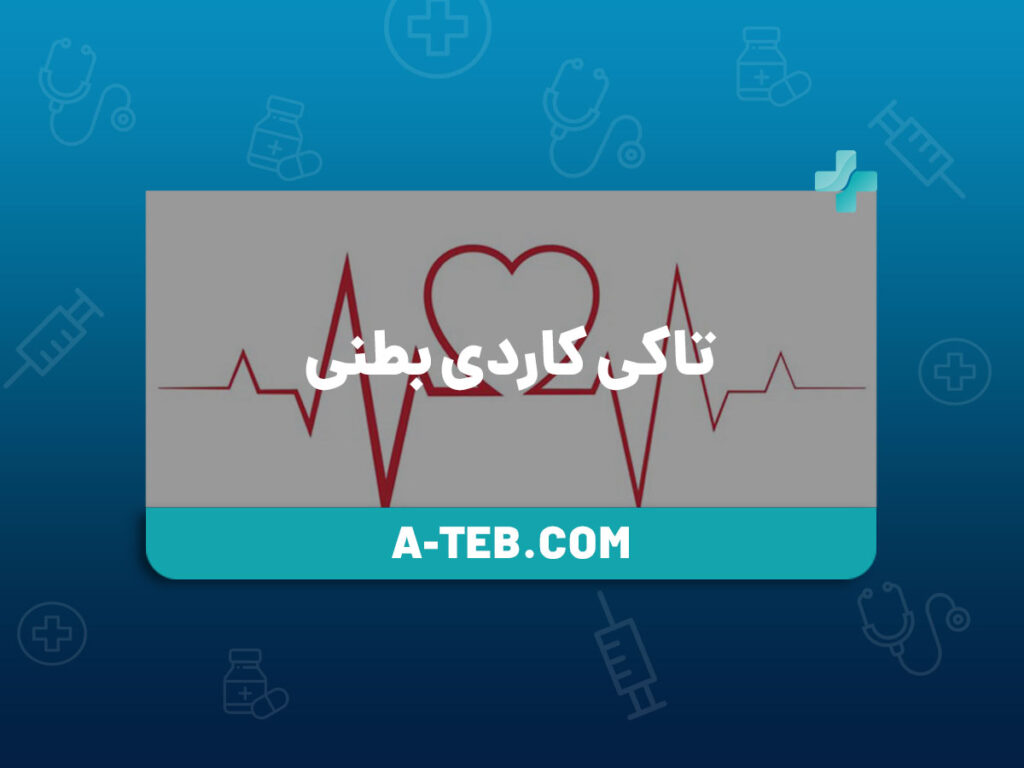 تاکی کاردی بطنی