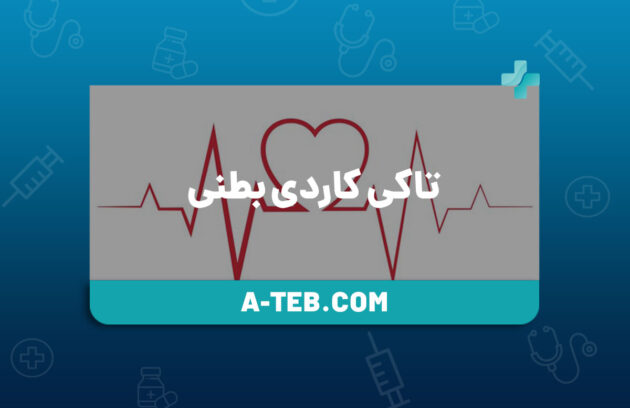 تاکی کاردی بطنی