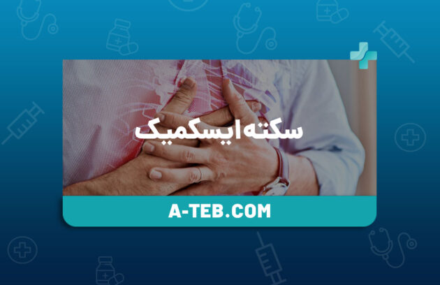 سکته ایسکمیک