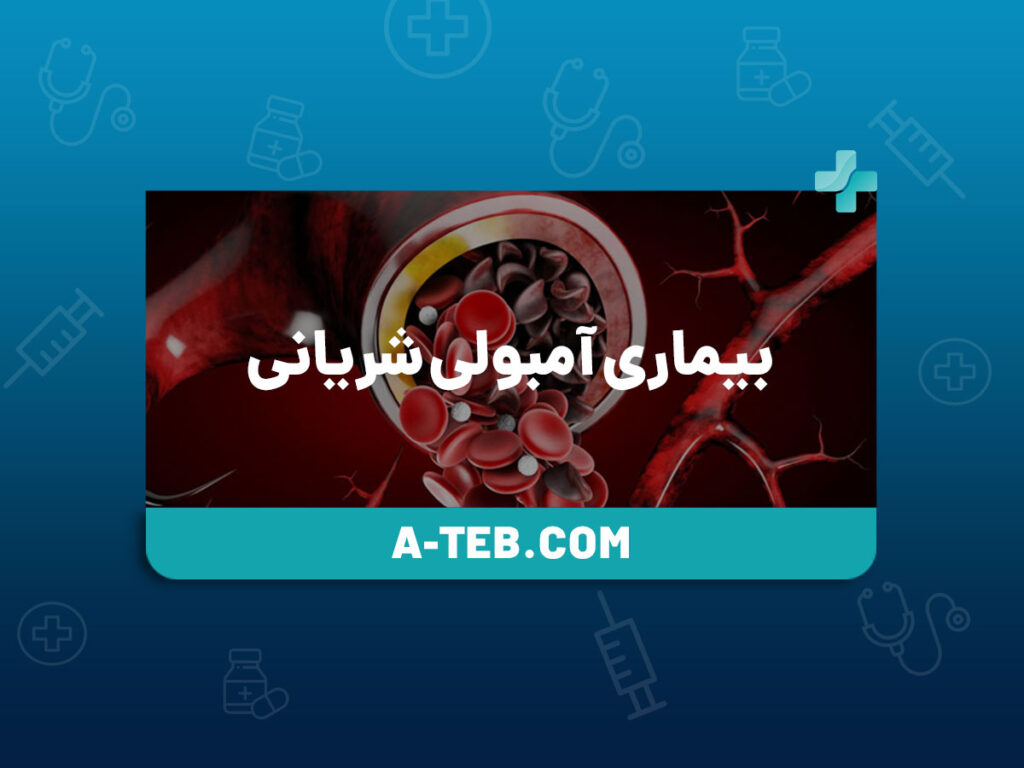 بیماری آمبولی شریانی