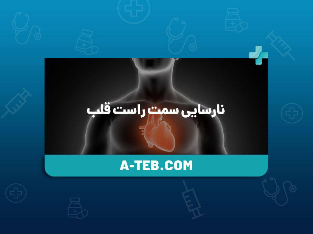 نارسایی سمت راست قلب