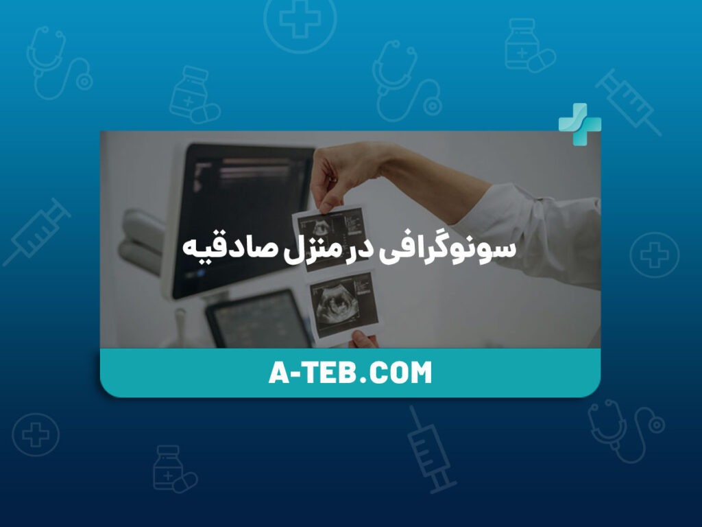 سونوگرافی در منزل صادقیه