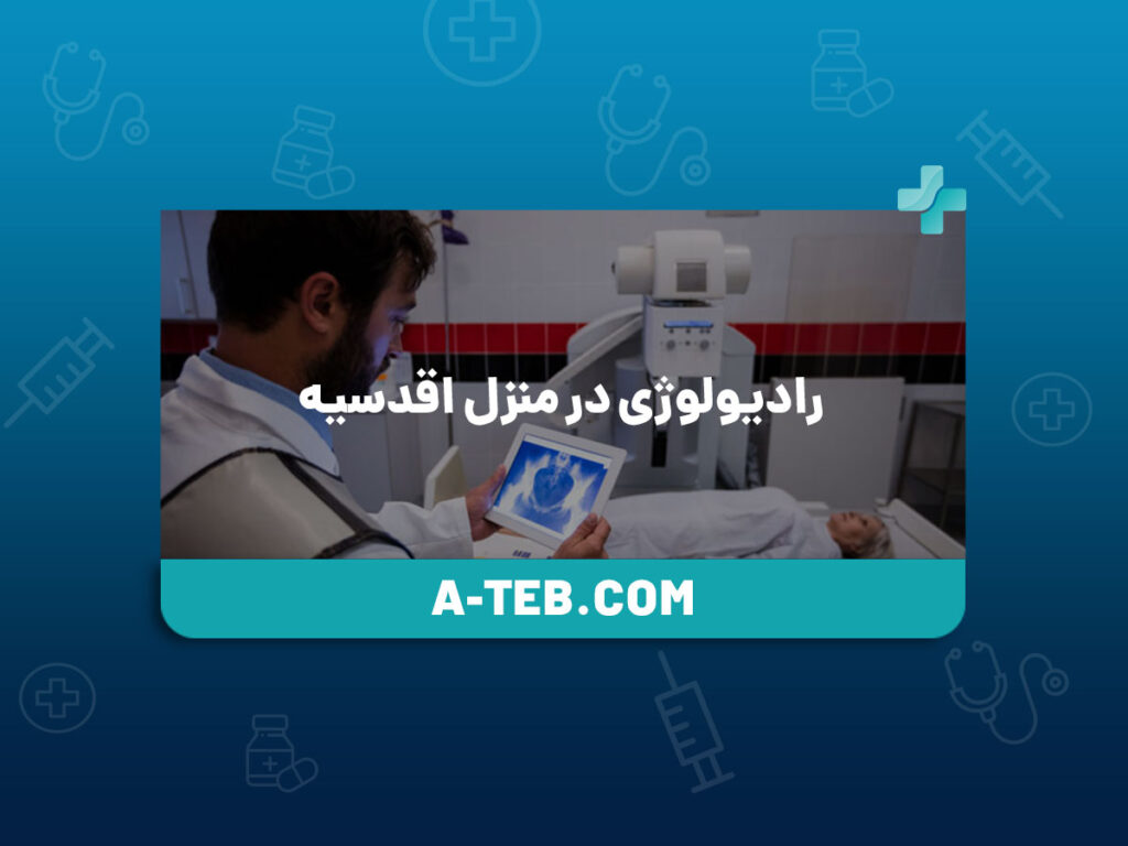 رادیولوژی در منزل اقدسیه