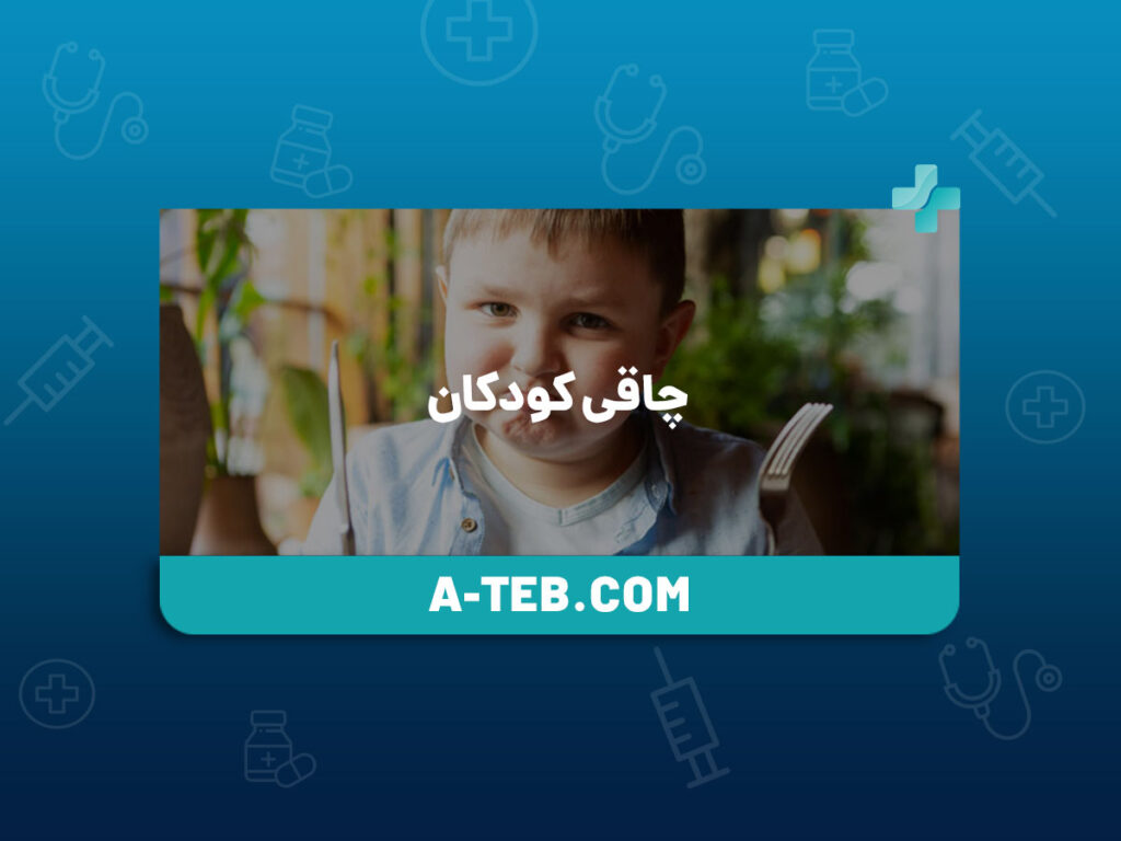 چاقی کودکان