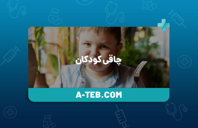 چاقی کودکان