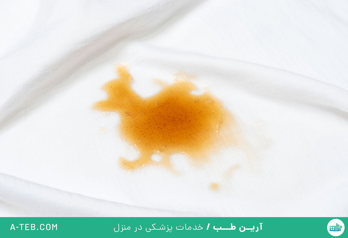 ترشحات قهوهای واژن
